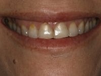 Konig Center for Cosmetic & Comprehensive Dentistry smile photos